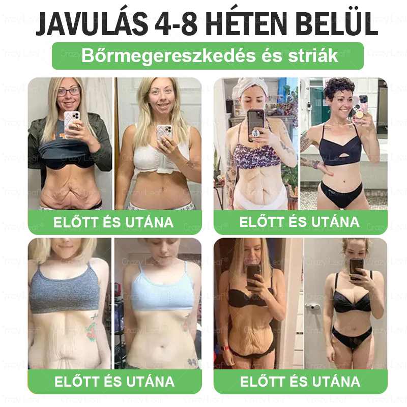 đ©ââïžMĂĄr csak 10 ĂŒveg maradt! KorlĂĄtozott idejƱ ajĂĄnlat, extra 50% kedvezmĂ©ny! Ragadd meg a lehetĆsĂ©get, hogy karcsĂșbb Ă©s energikusabb Ă©letet Ă©ljâš Ha lemaradsz rĂłla, jövĆre vĂĄrnod kell!