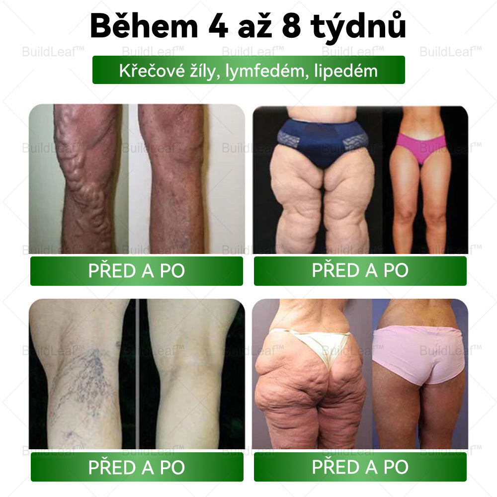 🎁 Már csak 10 üveg maradt! Korlátozott idejű ajánlat, extra 50% kedvezmény! Ragadd meg a lehetőséget, hogy karcsúbb és energikusabb életet élj✨ Ha lemaradsz róla, jövőre várnod kell!