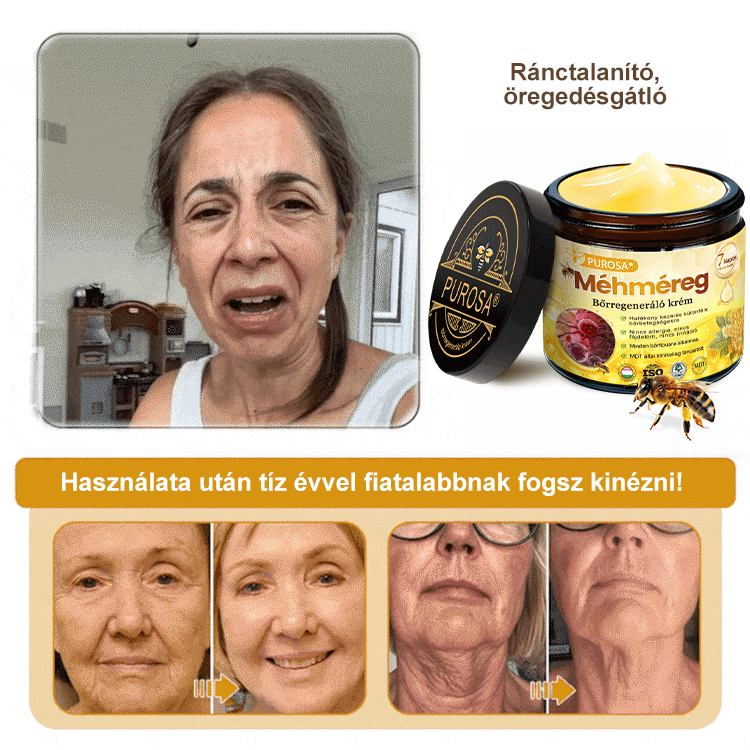 🐝PUROSA® Méhméreg Bőrmegújító Krém|✅Teljes körű megoldás a makacs bőrproblémák, például az öregedés, ekcéma, hegek és pikkelysömör ellen