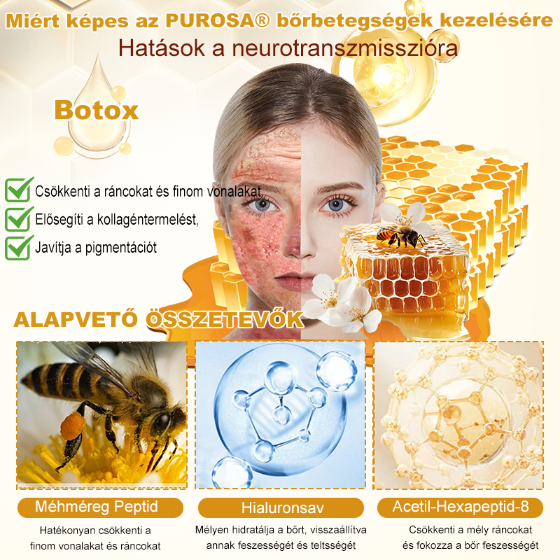 🐝PUROSA® Méhméreg Bőrmegújító Krém|✅Teljes körű megoldás a makacs bőrproblémák, például az öregedés, ekcéma, hegek és pikkelysömör ellen