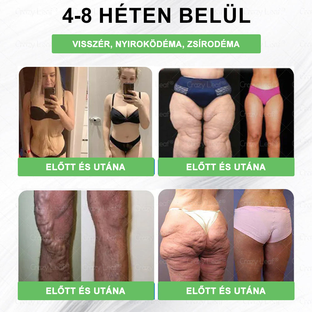 đ©ââïžMĂĄr csak 10 ĂŒveg maradt! KorlĂĄtozott idejƱ ajĂĄnlat, extra 50% kedvezmĂ©ny! Ragadd meg a lehetĆsĂ©get, hogy karcsĂșbb Ă©s energikusabb Ă©letet Ă©ljâš Ha lemaradsz rĂłla, jövĆre vĂĄrnod kell!
