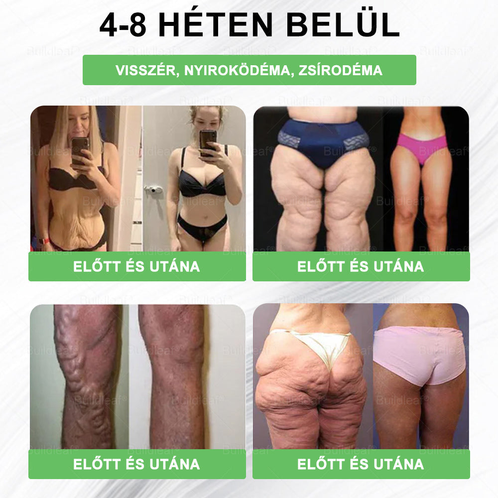 đż Klinikai kutatĂĄsokkal igazolt | A BuildLeafÂź Berberine GLP-1 Pro SĂșlycsökkentĆ SzĂĄjon ĂĄt szedhetĆ oldat segĂthet a makacs sĂșlytöbblet, anyagcsere- Ă©s energiaproblĂ©mĂĄk kezelĂ©sĂ©ben, tĂĄmogatva a jobb közĂ©rzetet Ă©s vitalitĂĄst