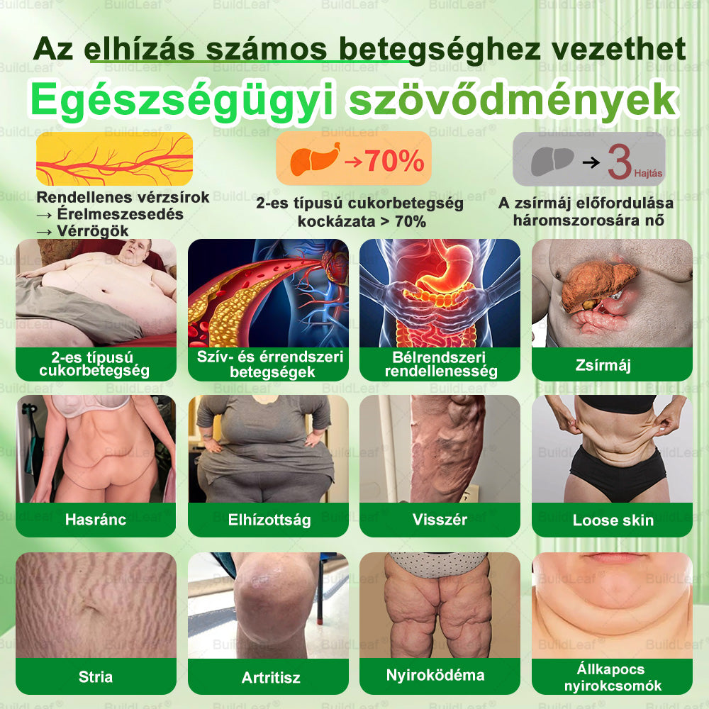 BuildLeaf®20-1🎁 Tylko 10 opakowań! Skorzystaj z wyjątkowej 30% zniżki teraz! Nie przegap szansy — taka oferta wróci dopiero w przyszłym roku. Działaj szybko! 180-dniowa gwarancja zwrotu pieniędzy!