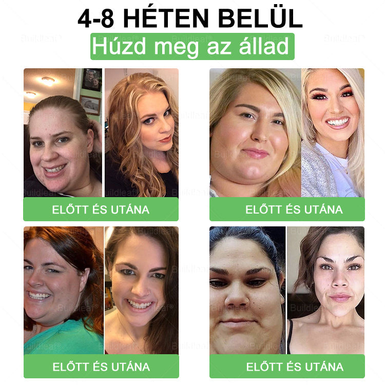 đż Klinikai kutatĂĄsokkal igazolt | A BuildLeafÂź Berberine GLP-1 Pro SĂșlycsökkentĆ SzĂĄjon ĂĄt szedhetĆ oldat segĂthet a makacs sĂșlytöbblet, anyagcsere- Ă©s energiaproblĂ©mĂĄk kezelĂ©sĂ©ben, tĂĄmogatva a jobb közĂ©rzetet Ă©s vitalitĂĄst