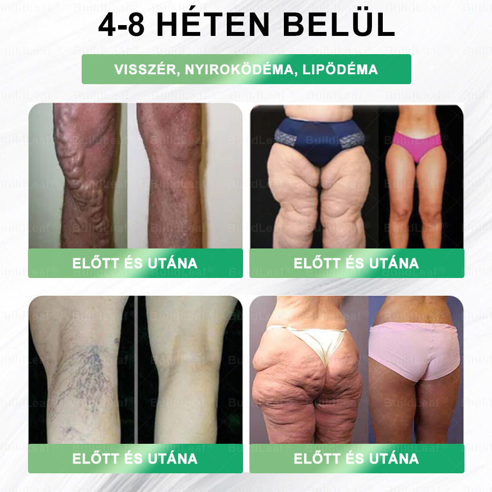 💊BuildLeaf®🎁 Tylko 10 opakowań! Skorzystaj z wyjątkowej 30% zniżki teraz! Nie przegap szansy — taka oferta wróci dopiero w przyszłym roku. Działaj szybko! 180-dniowa gwarancja zwrotu pieniędzy!