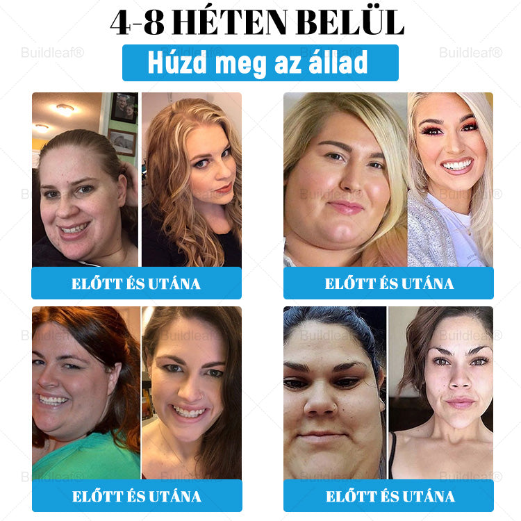 đ MĂĄr csak 10 ĂŒveg maradt! KorlĂĄtozott idejƱ ajĂĄnlat, extra 50% kedvezmĂ©ny! Ragadd meg a lehetĆsĂ©get, hogy karcsĂșbb Ă©s energikusabb Ă©letet Ă©ljâš Ha lemaradsz rĂłla, jövĆre vĂĄrnod kell!