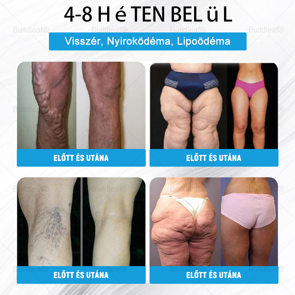đ MĂĄr csak 10 ĂŒveg maradt! KorlĂĄtozott idejƱ ajĂĄnlat, extra 50% kedvezmĂ©ny! Ragadd meg a lehetĆsĂ©get, hogy karcsĂșbb Ă©s energikusabb Ă©letet Ă©ljâš Ha lemaradsz rĂłla, jövĆre vĂĄrnod kell!