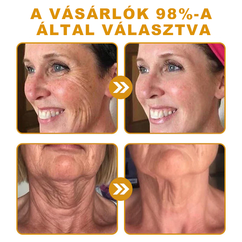 🐝PUROSA® Méhméreg Bőrmegújító Krém|✅Teljes körű megoldás a makacs bőrproblémák, például az öregedés, ekcéma, hegek és pikkelysömör ellen