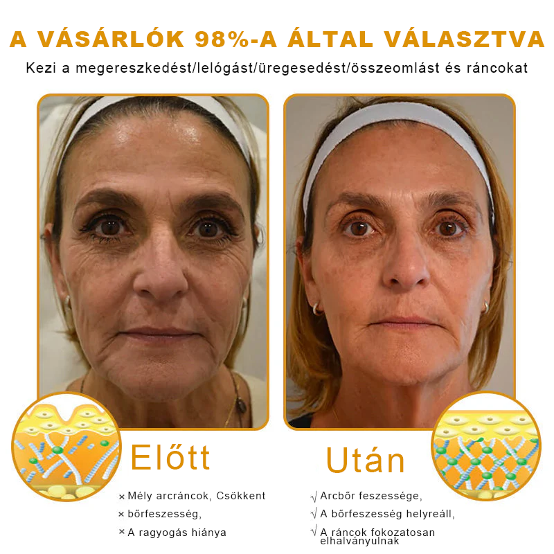 🐝PUROSA® Méhméreg Bőrmegújító Krém|✅Teljes körű megoldás a makacs bőrproblémák, például az öregedés, ekcéma, hegek és pikkelysömör ellen
