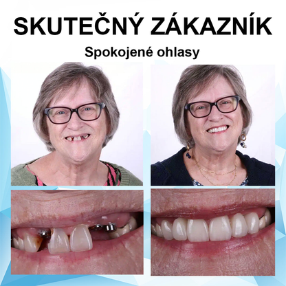 🎁 Zbývá už jen 5 krabiček! Nabízíme dodatečnou slevu 50%! Postarejte se o svou kondici a zdraví. Pokud to teď propásnete, další šance bude až příští rok.