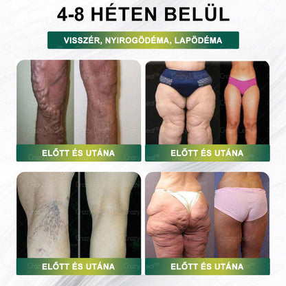 🎁 Már csak 10 üveg maradt! Korlátozott idejű ajánlat, extra 50% kedvezmény! Ragadd meg a lehetőséget, hogy karcsúbb és energikusabb életet élj✨ Ha lemaradsz róla, jövőre várnod kell!
