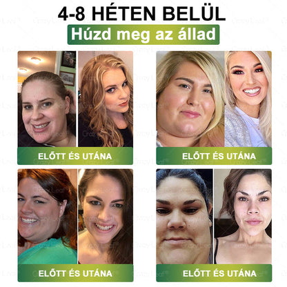 🎁 Már csak 10 üveg maradt! Korlátozott idejű ajánlat, extra 50% kedvezmény! Ragadd meg a lehetőséget, hogy karcsúbb és energikusabb életet élj✨ Ha lemaradsz róla, jövőre várnod kell!