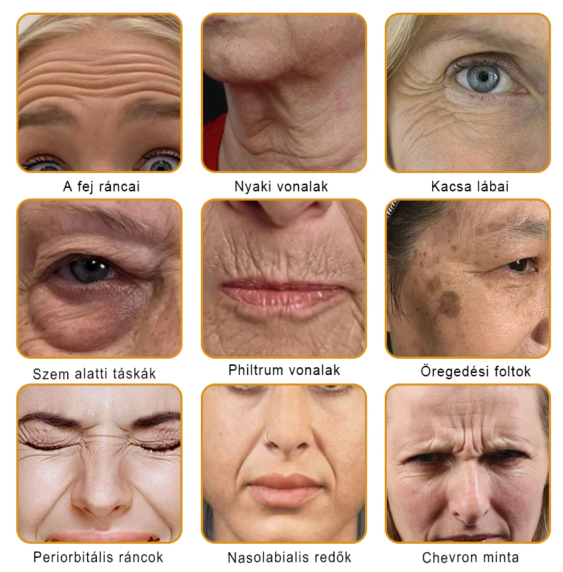 🐝PUROSA® Méhméreg Bőrmegújító Krém｜✅Teljes körű megoldás a makacs bőrproblémák, például az öregedés, ekcéma, hegek és pikkelysömör ellen